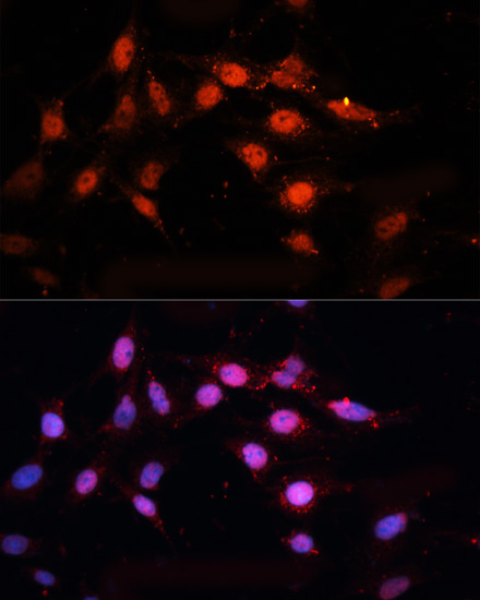 Immunofluorescence - CTBP2 Polyclonal Antibody 