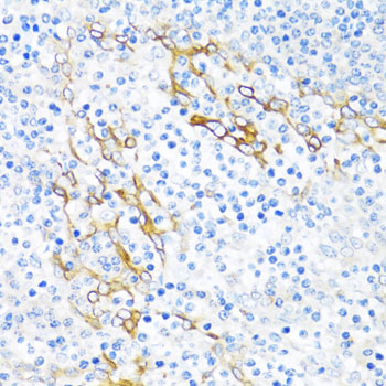 Immunohistochemistry - PLA2G4C Polyclonal Antibody 