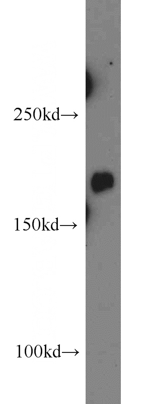 mouse brain tissue were subjected to SDS PAGE followed by western blot with Catalog No:114262(PTCH1 antibody) at dilution of 1:500