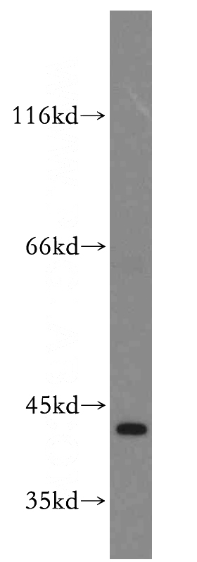 mouse lung tissue were subjected to SDS PAGE followed by western blot with Catalog No:108935(CAPG-Specific antibody) at dilution of 1:300
