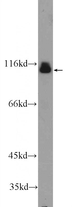 mouse brain tissue were subjected to SDS PAGE followed by western blot with Catalog No:107734(CNNM1 Antibody) at dilution of 1:1000