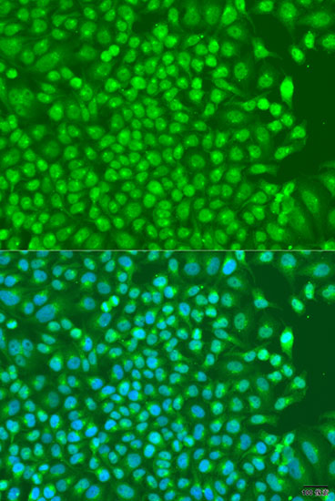 Immunofluorescence - NKX2-5 Polyclonal Antibody 