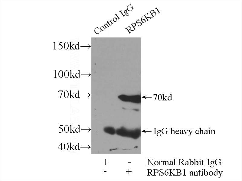 IP Result of anti-p70(S6K) (IP:Catalog No:113560, 3ug; Detection:Catalog No:113560 1:1000) with HeLa cells lysate 3000ug.