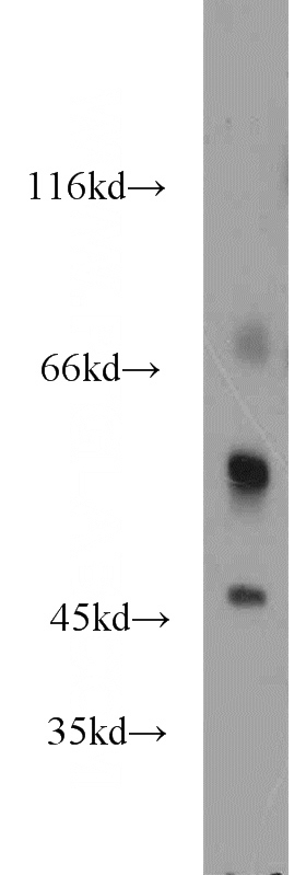 mouse brain tissue were subjected to SDS PAGE followed by western blot with Catalog No:112361(LTBR antibody) at dilution of 1:1000