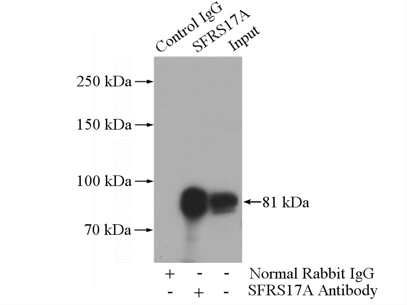 IP Result of anti-SFRS17A (IP:Catalog No:115148, 4ug; Detection:Catalog No:115148 1:500) with Jurkat cells lysate 2800ug.