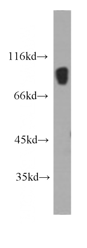 human testis tissue were subjected to SDS PAGE followed by western blot with Catalog No:107278(IFT88 antibody) at dilution of 1:1000