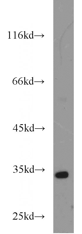 K-562 cells were subjected to SDS PAGE followed by western blot with Catalog No:111309(HEY2 antibody) at dilution of 1:500