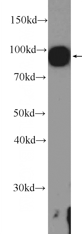 rat liver tissue were subjected to SDS PAGE followed by western blot with Catalog No:114359(PYGL Antibody) at dilution of 1:1000