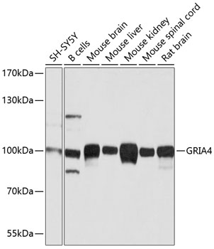 Western blot - GRIA4 Polyclonal Antibody 