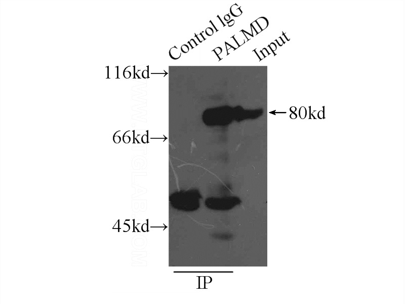 IP Result of anti-PALMD (IP:Catalog No:113564, 5ug; Detection:Catalog No:113564 1:500) with mouse heart tissue lysate 6000ug.
