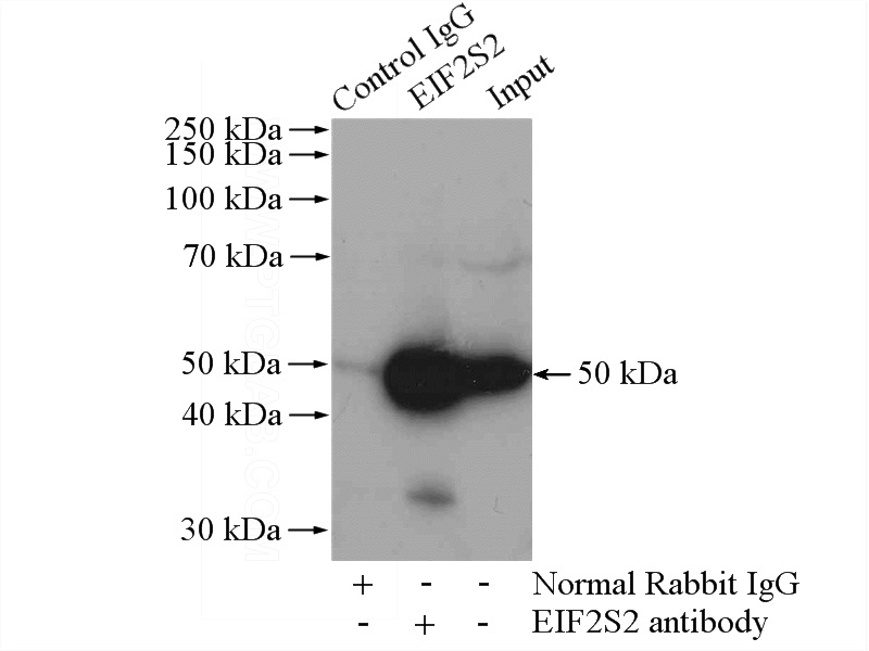 IP Result of anti-EIF2S2 (IP:Catalog No:110188, 4ug; Detection:Catalog No:110188 1:1000) with mouse liver tissue lysate 4000ug.