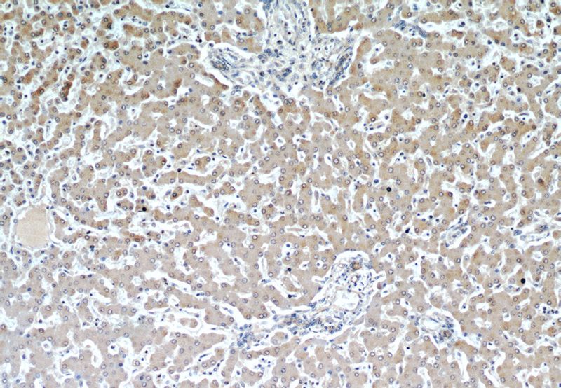 Immunohistochemical of paraffin-embedded human liver using Catalog No:108196(ARL13B antibody) at dilution of 1:50 (under 10x lens)