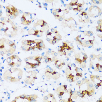Immunohistochemistry - ARSB Polyclonal Antibody 