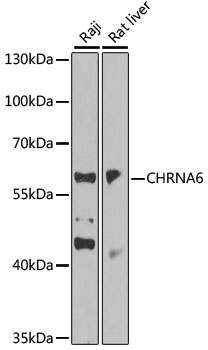 Western blot - CHRNA6 Polyclonal Antibody 