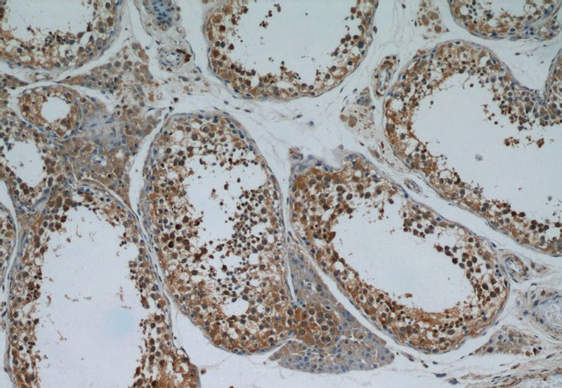 Immunohistochemical of paraffin-embedded human testis using Catalog No:114089(PPP1R2P9 antibody) at dilution of 1:50 (under 10x lens)