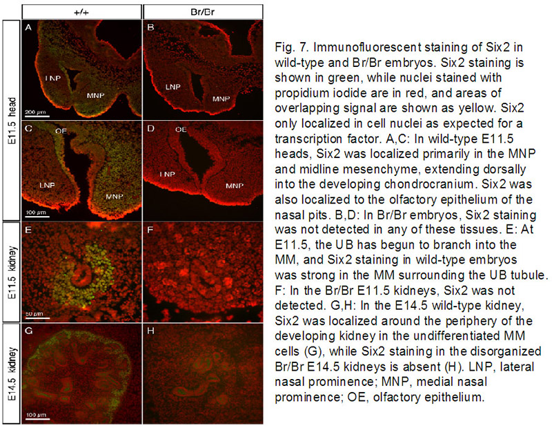 IF result from Fogelgren B, PMID:18570229, 