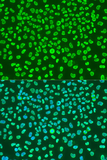 Immunofluorescence - KHDRBS1 Polyclonal Antibody 
