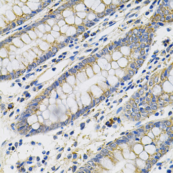 Immunohistochemistry - PLGF Polyclonal Antibody 