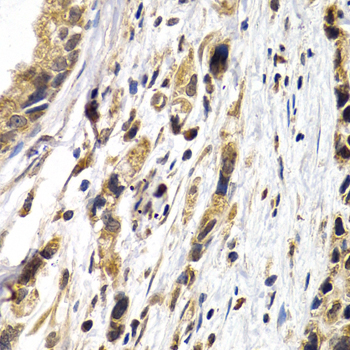 Immunohistochemistry - PTHLH Polyclonal Antibody 