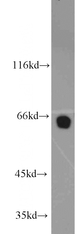 PC-3 cells were subjected to SDS PAGE followed by western blot with Catalog No:113381(NUP62 antibody) at dilution of 1:1500