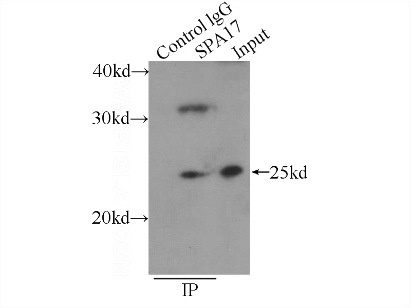 IP Result of anti-SPA17 (IP:Catalog No:115526, 3ug; Detection:Catalog No:115526 1:400) with mouse testis tissue lysate 4800ug.