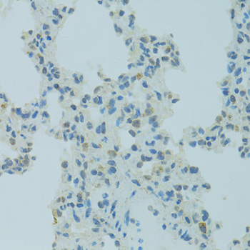 Immunohistochemistry - MBD2 Polyclonal Antibody 