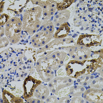 Immunohistochemistry - AURKC Polyclonal Antibody 