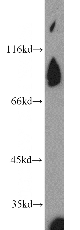 human testis tissue were subjected to SDS PAGE followed by western blot with Catalog No:114673(REC8 antibody) at dilution of 1:1000