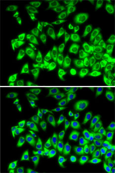 Immunofluorescence - RPL13 Polyclonal Antibody 