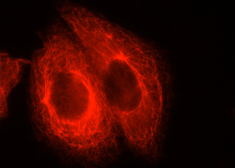Immunofluorescent analysis of HepG2 cells using Catalog No:109810(KRT7 Antibody) at dilution of 1:50 and Rhodamine-labeled goat anti-rabbit IgG (red).