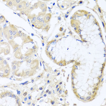 Immunohistochemistry - INPP5K Polyclonal Antibody 