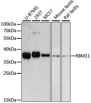 Western blot - RBM11 Polyclonal Antibody 