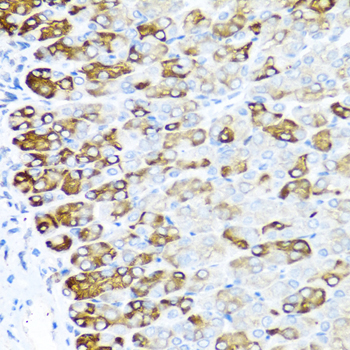 Immunohistochemistry - MGP Polyclonal Antibody 