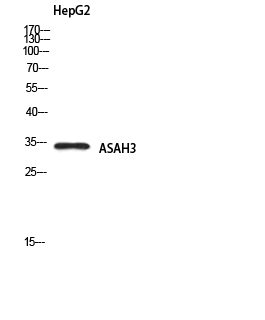 Fig1:; Western blot analysis of HepG2 using ASAH3 antibody.. Secondary antibody（catalog#: HA1001) was diluted at 1:20000