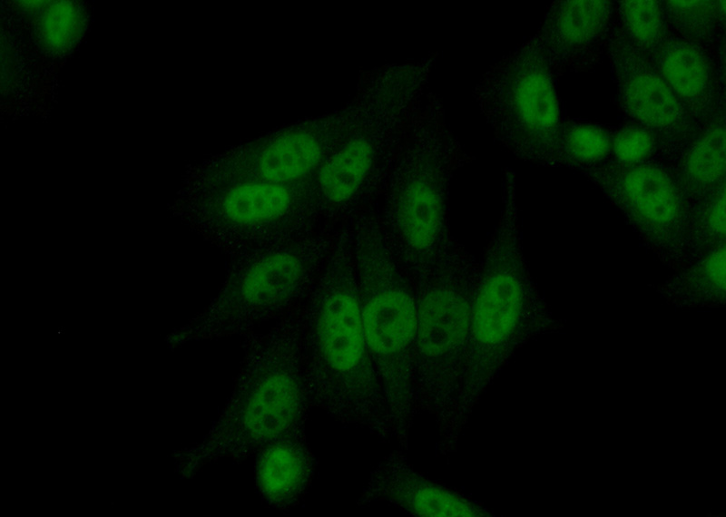Immunofluorescent analysis of (10% Formaldehyde) fixed HeLa cells using Catalog No:109529(CPSF7 Antibody) at dilution of 1:50 and Alexa Fluor 488-congugated AffiniPure Goat Anti-Rabbit IgG(H+L)
