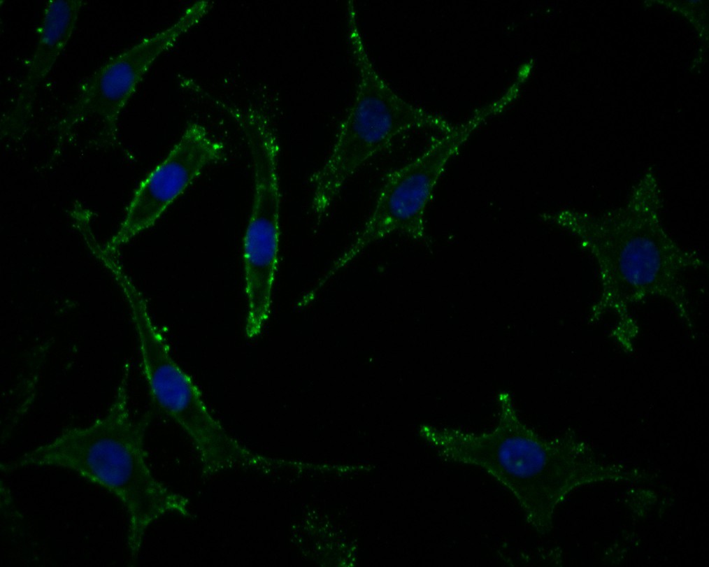 Fig2:; ICC staining of Neurabin 1 in SH-SY5Y cells (green). Formalin fixed cells were permeabilized with 0.1% Triton X-100 in TBS for 10 minutes at room temperature and blocked with 10% negative goat serum for 15 minutes at room temperature. Cells were probed with the primary antibody ( 1/50) for 1 hour at room temperature, washed with PBS. Alexa Fluor®488 conjugate-Goat anti-Rabbit IgG was used as the secondary antibody at 1/1,000 dilution. The nuclear counter stain is DAPI (blue).