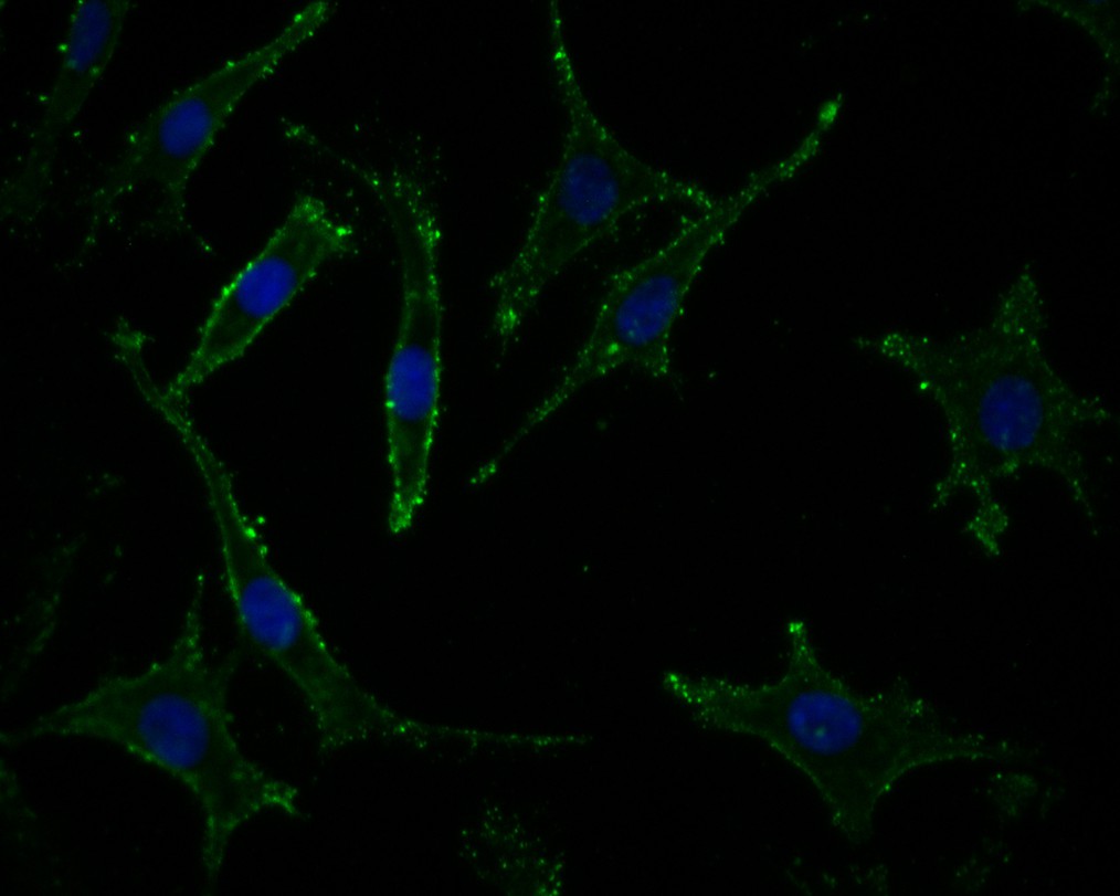 Fig2:; ICC staining of Neurabin 1 in SH-SY5Y cells (green). Formalin fixed cells were permeabilized with 0.1% Triton X-100 in TBS for 10 minutes at room temperature and blocked with 10% negative goat serum for 15 minutes at room temperature. Cells were probed with the primary antibody ( 1/50) for 1 hour at room temperature, washed with PBS. Alexa Fluor®488 conjugate-Goat anti-Rabbit IgG was used as the secondary antibody at 1/1,000 dilution. The nuclear counter stain is DAPI (blue).
