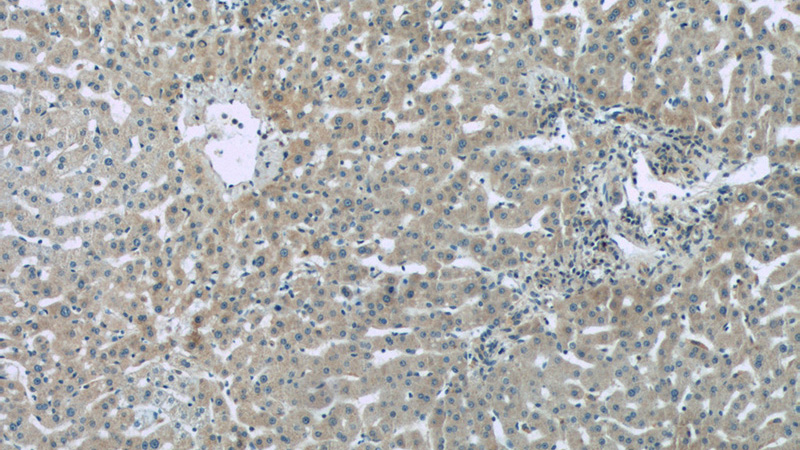 Immunohistochemistry of paraffin-embedded human liver tissue slide using Catalog No:109446(CFB Antibody) at dilution of 1:50 (under 10x lens)