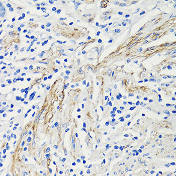 Immunohistochemistry - CCL4 Polyclonal Antibody 