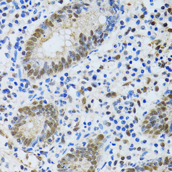 Immunohistochemistry - MTA3 Polyclonal Antibody 