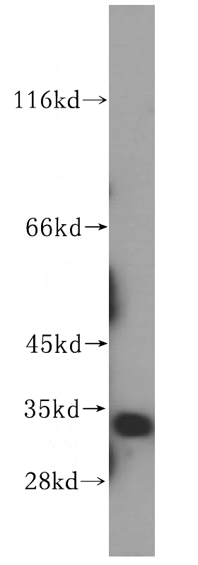 HeLa cells were subjected to SDS PAGE followed by western blot with Catalog No:115246(SIRT5 antibody) at dilution of 1:400