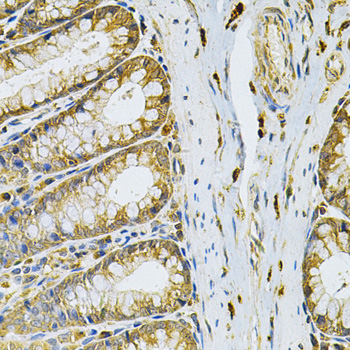 Immunohistochemistry - RRAGC Polyclonal Antibody 