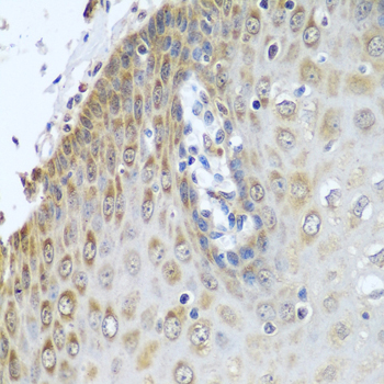 Immunohistochemistry - POR Polyclonal Antibody 