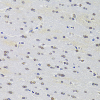 Immunohistochemistry - PRPF3 Polyclonal Antibody 