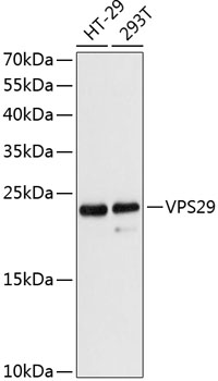Western blot - VPS29 Polyclonal Antibody 