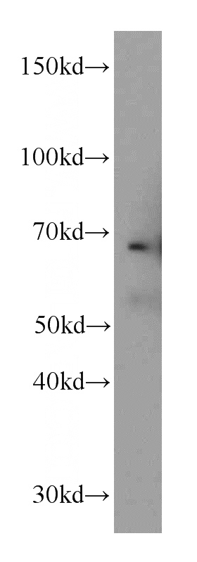 mouse heart tissue were subjected to SDS PAGE followed by western blot with Catalog No:110661(FBLN5 antibody) at dilution of 1:400