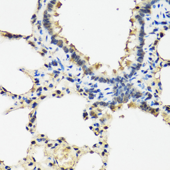 Immunohistochemistry - ARSF Polyclonal Antibody 