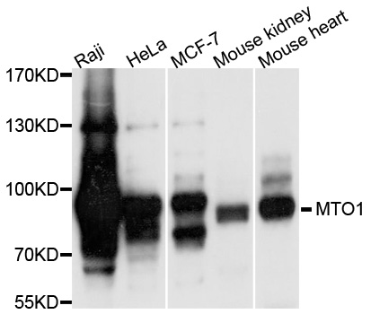 Western blot - MTO1 Polyclonal Antibody 