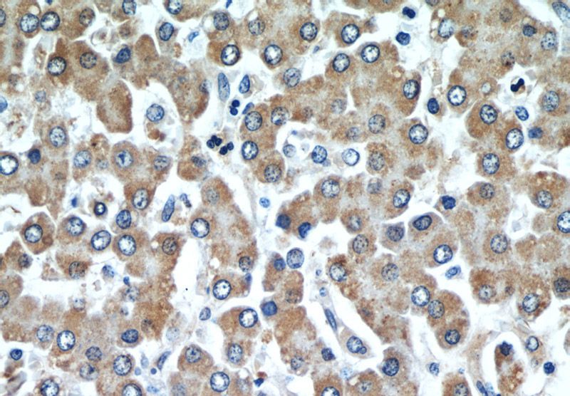 Immunohistochemical of paraffin-embedded human liver using Catalog No:107228(CYGB antibody) at dilution of 1:50 (under 40x lens)