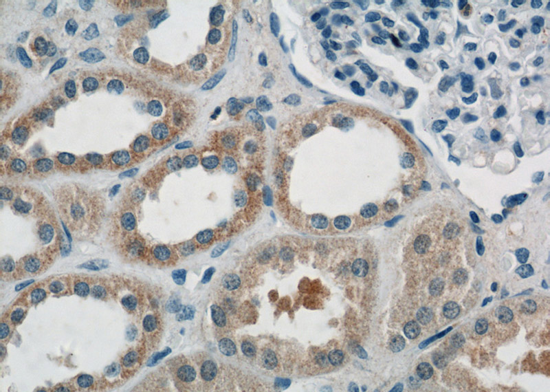 Immunohistochemistry of paraffin-embedded human kidney tissue slide using Catalog No:107950(AKT3 Antibody) at dilution of 1:50 (under 40x lens)